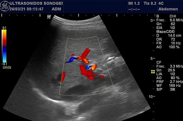 ULTRASONIDO SONOGENIK