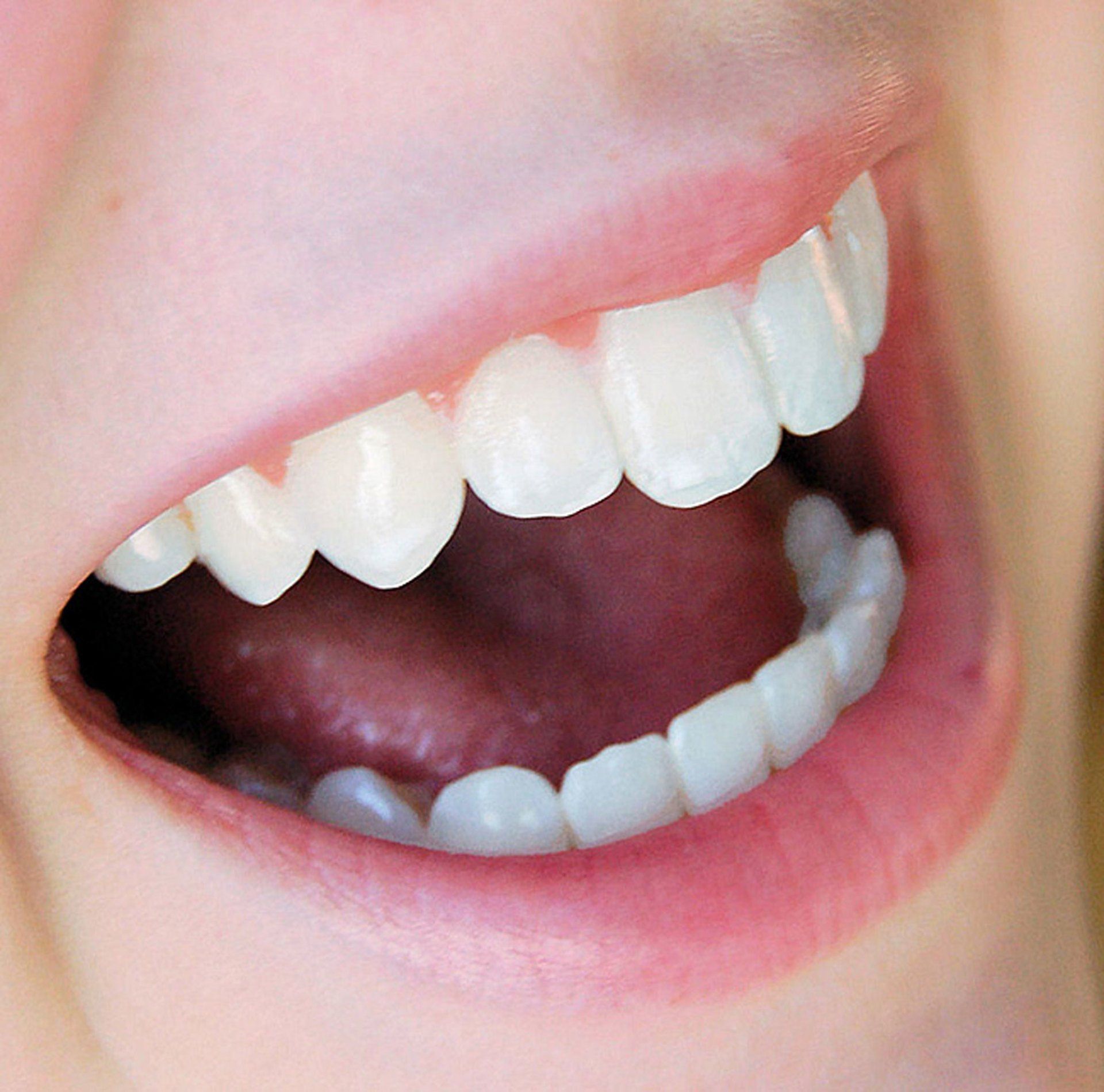 Eine Nahaufnahme der Zähne einer Person mit offenem Mund