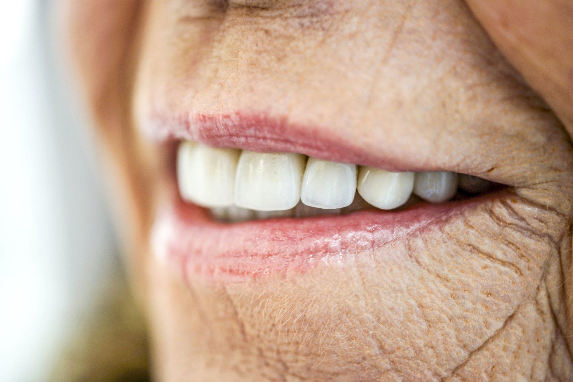 A close up of an elderly woman 's smile with white teeth.