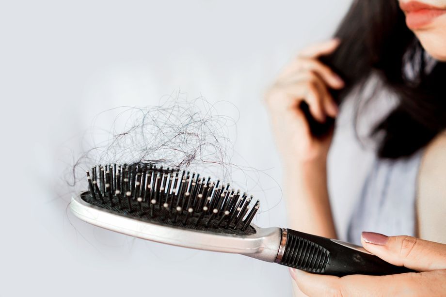 Best hair loss solution in Malaysia
