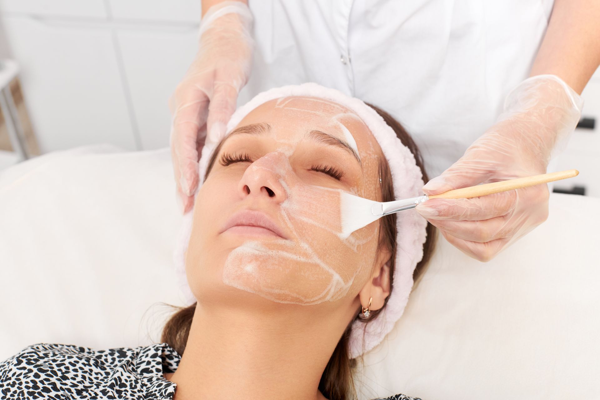 how does chemical peel work