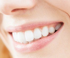 Dental Concern  — Close Up Image of Smiling Woman in Warwick, RI
