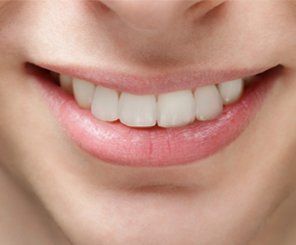 Dental Cure — Smiling with White teeth in Warwick, RI