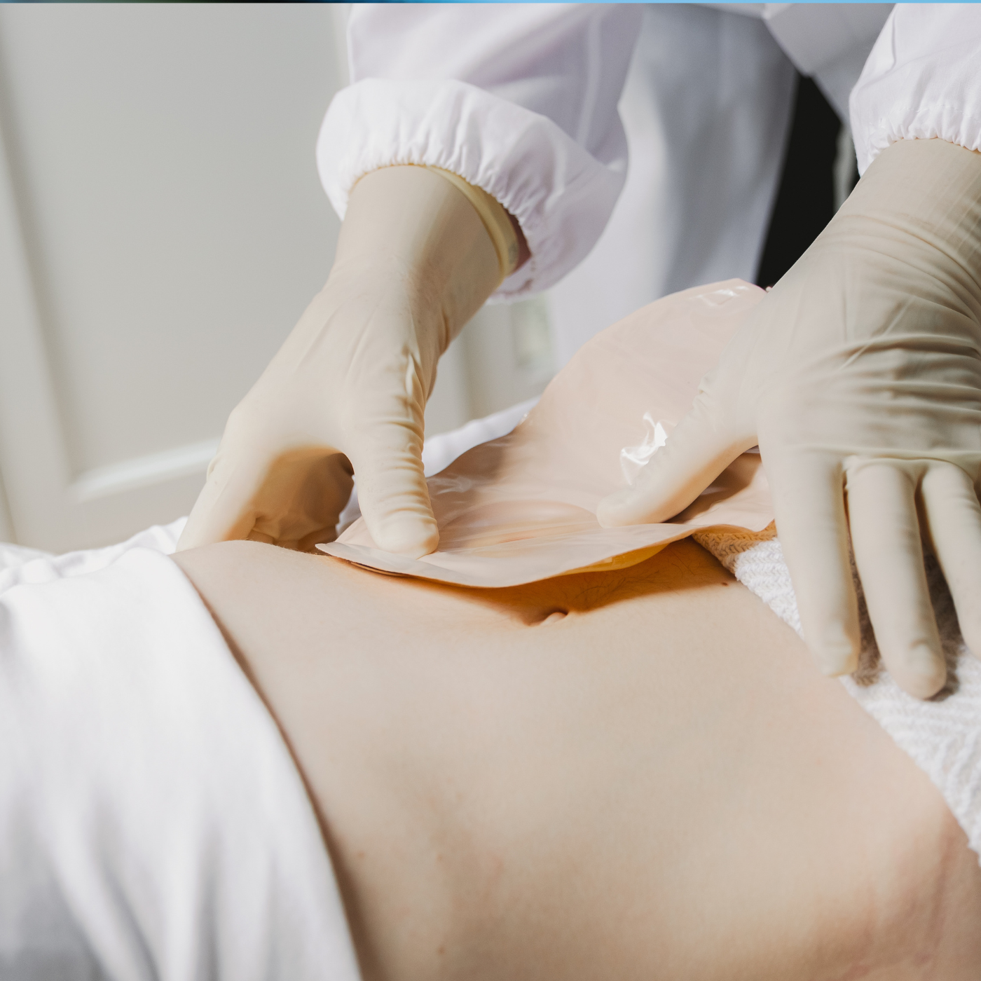 Pessoa de luvas aplicando bandagem no abdômen.