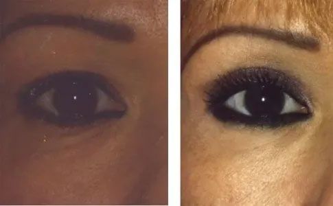 Comparison of a woman's eye: before, with slight dark circles; after, with heavy black eye makeup.