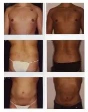 Multiple views of a person's torso, showing changes in physique. Skin tones vary, with visible body parts.