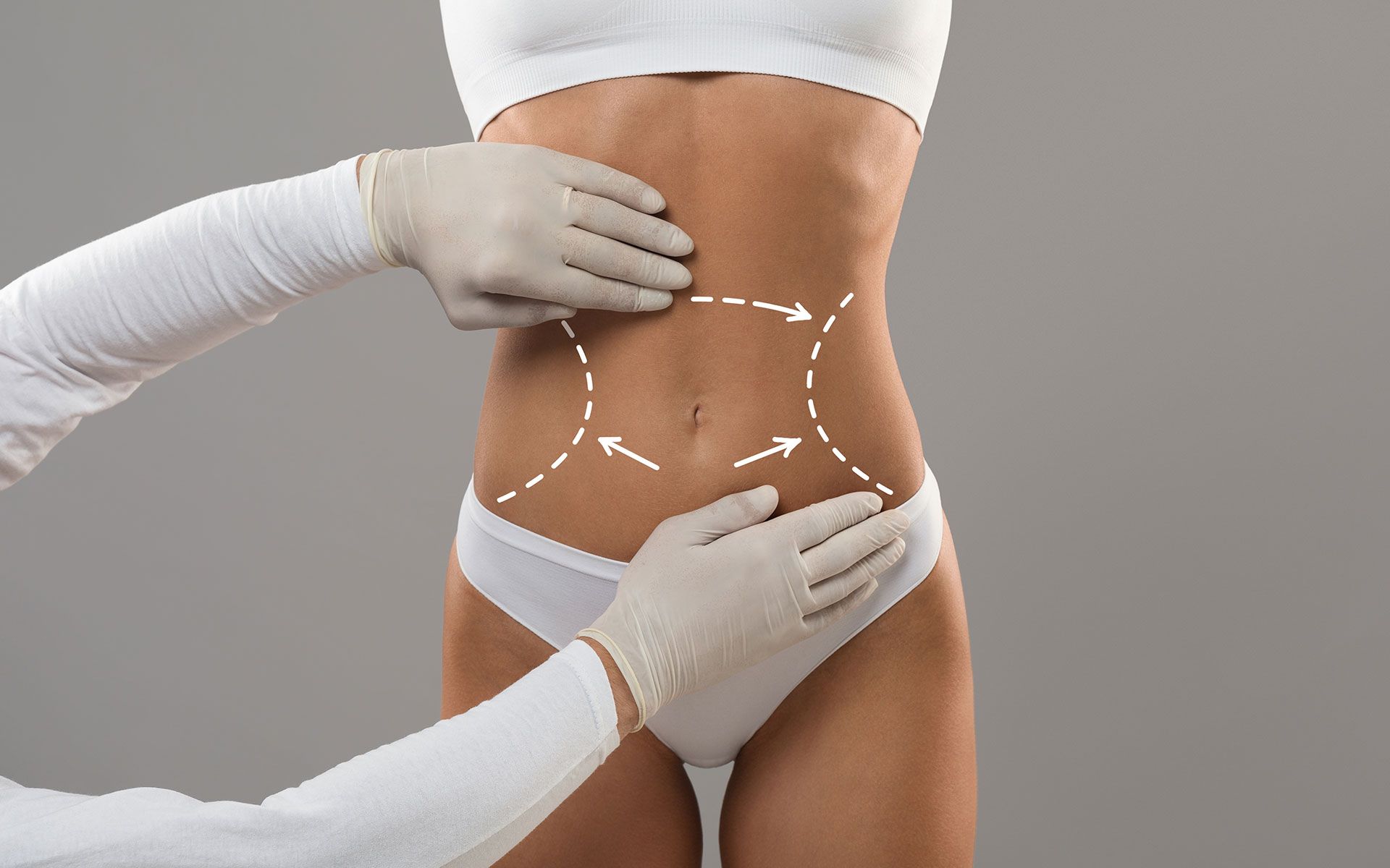 Hands of a medical professional marking a woman’s abdomen for a cosmetic procedure.