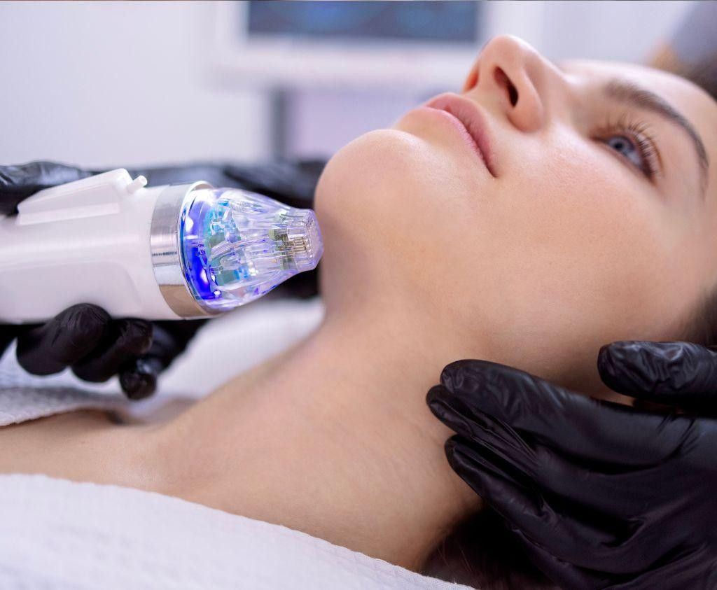 Areas RF Microneedling Can Treat