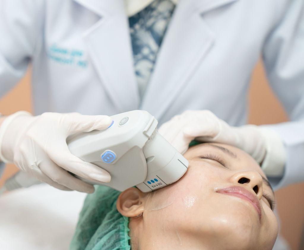 Areas Ultherapy Treats