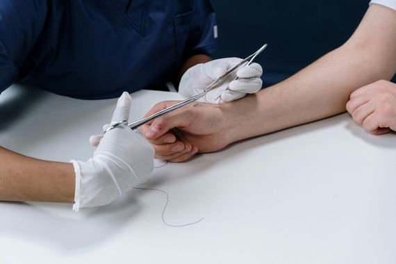 A healthcare professional in blue scrubs and white gloves uses a needle driver to practice suturing on a hand.