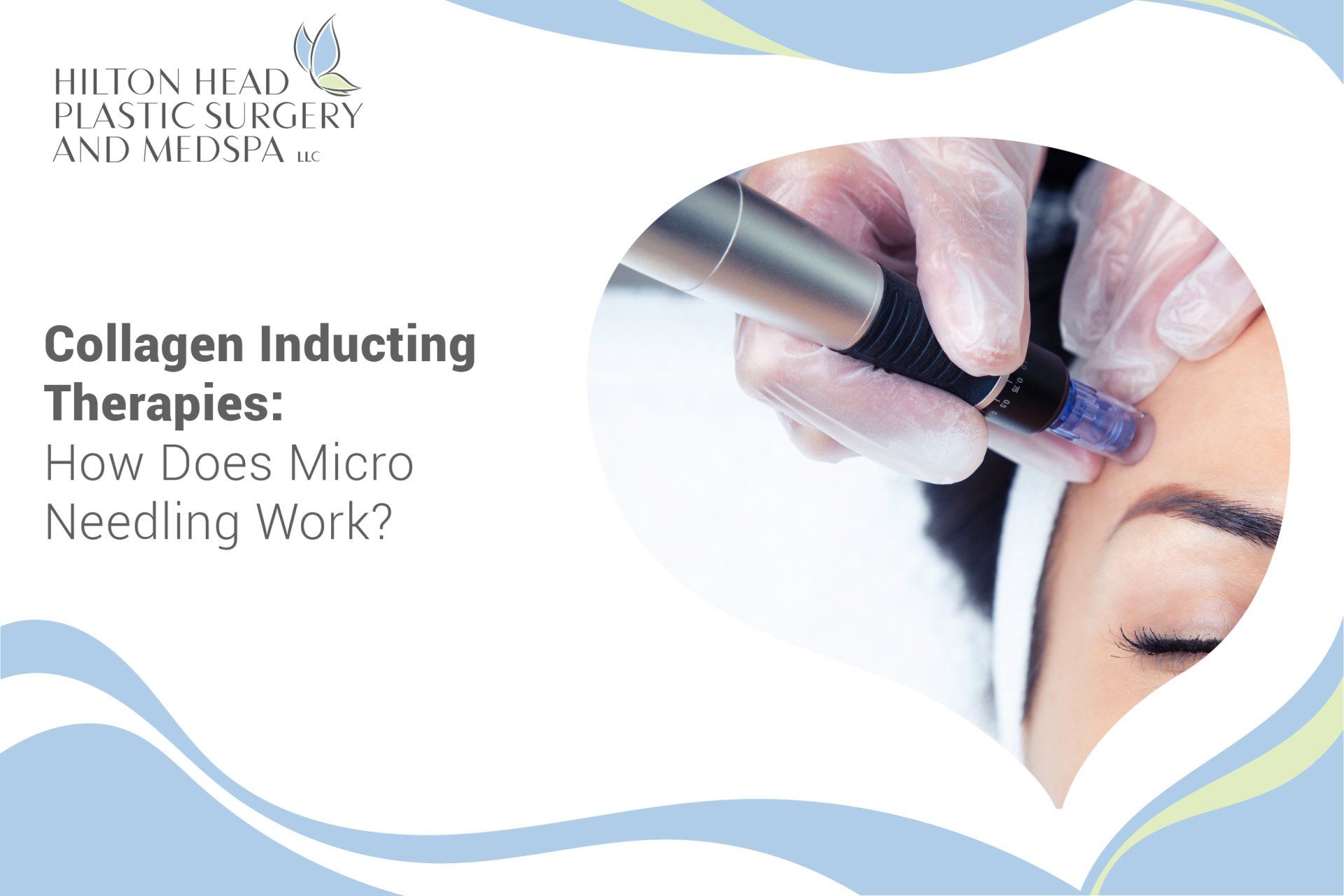 Collagen Inducting Therapies: How Does Micro Needling Work?