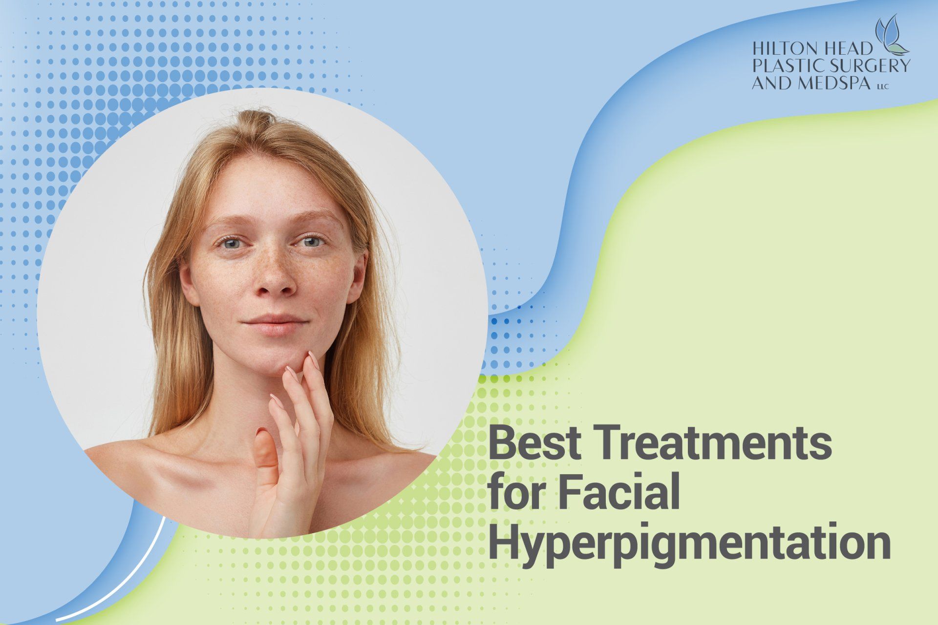 Best Treatments for Facial Hyperpigmentation