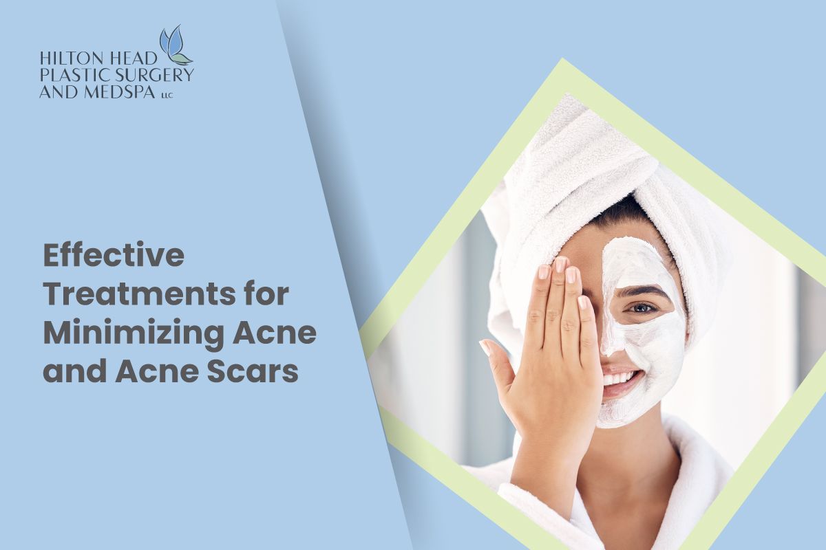 Effective Treatments for Minimizing Acne and Acne Scars