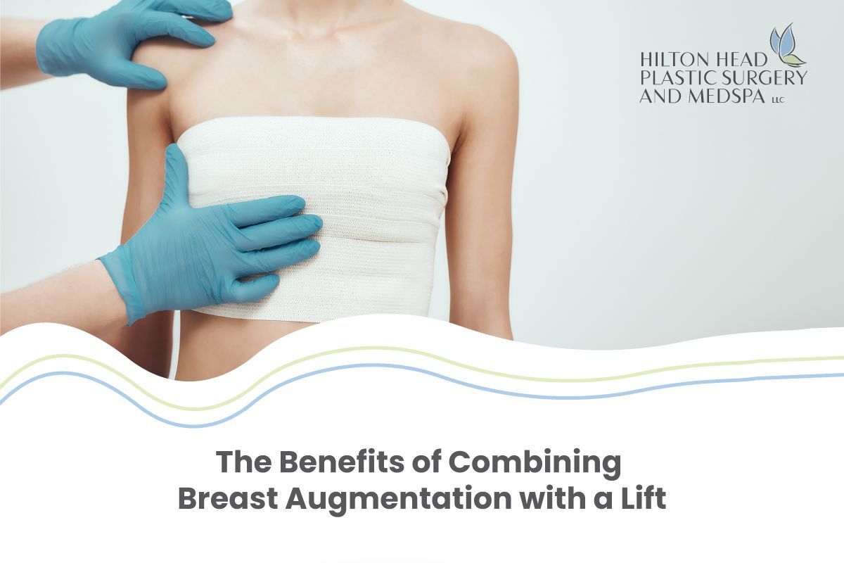 The Benefits of Combining Breast Augmentation with a Lift
