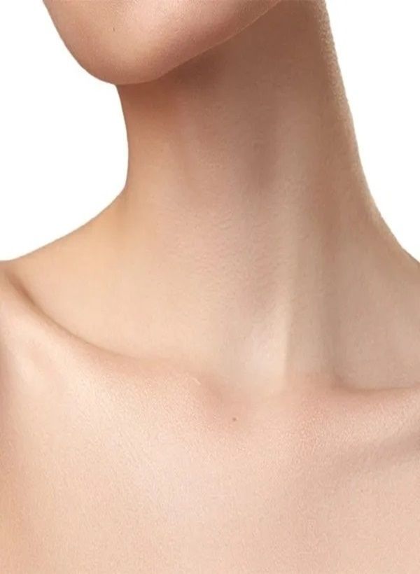 neck lift surgery