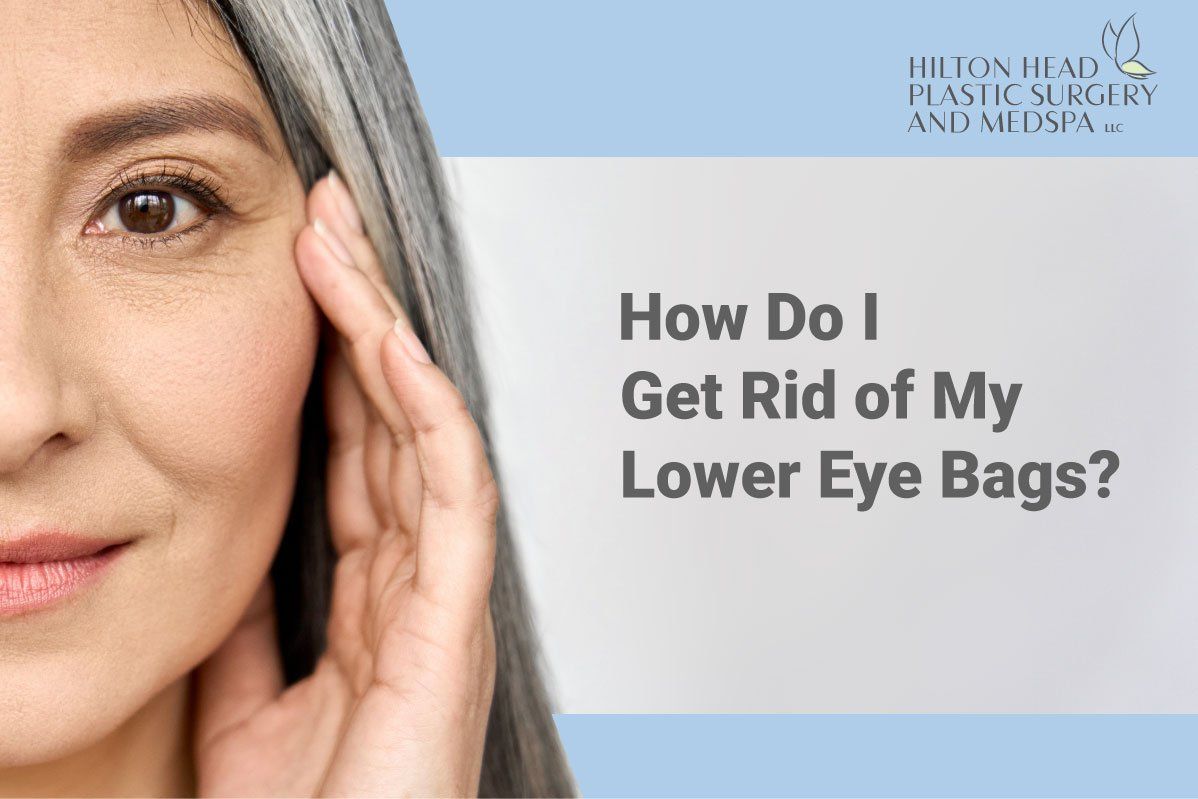 How Do I Get Rid of My Lower Eye Bags?