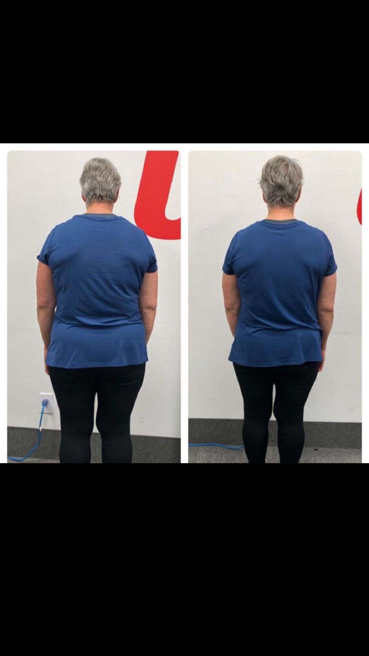 Side-by-side photos of a person from behind.. Posture appears improved in right photo.