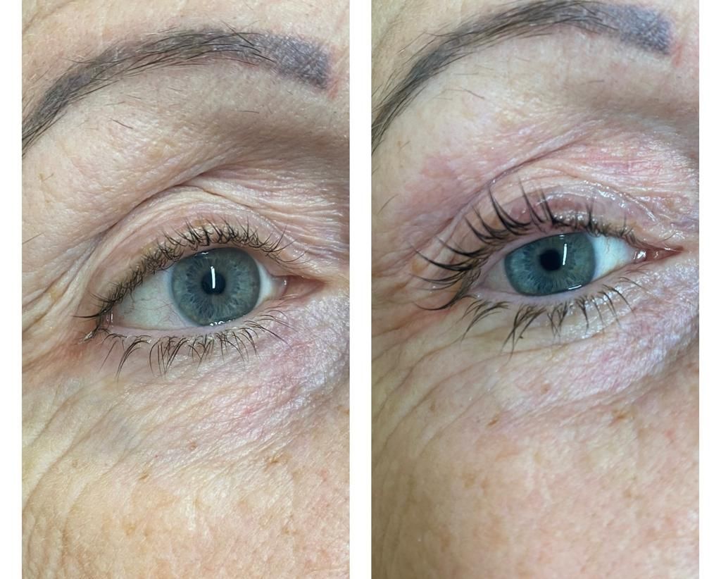 Una foto prima e dopo dell'occhio di una donna.