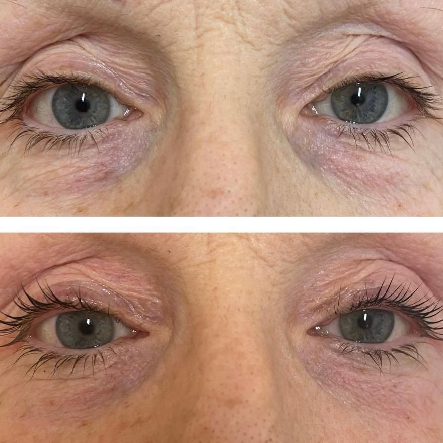 Una foto prima e dopo degli occhi di una donna.