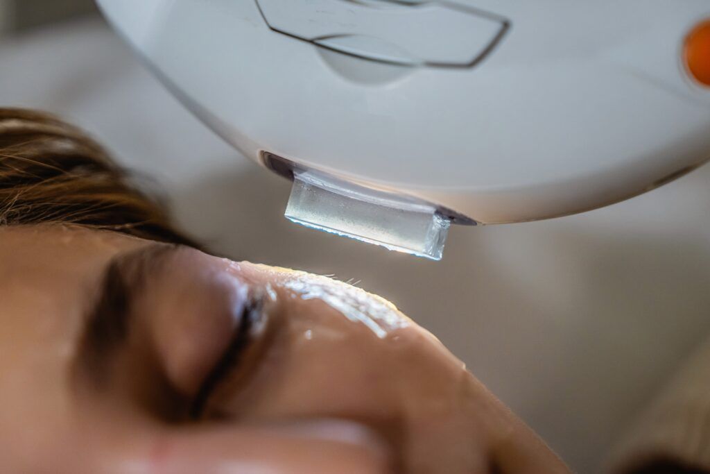 icl-skincare-therapy-shutterstock-ipl-photo-facial