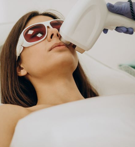Woman receiving laser hair removal treatment on her upper lip, wearing protective eyewear.