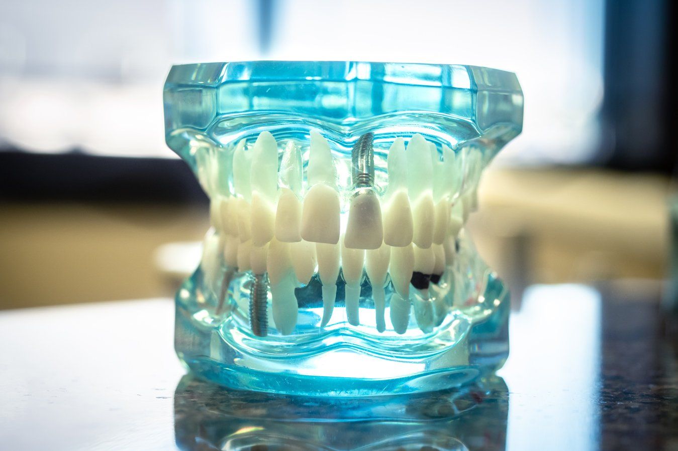 Sample teeth structure cosmetic