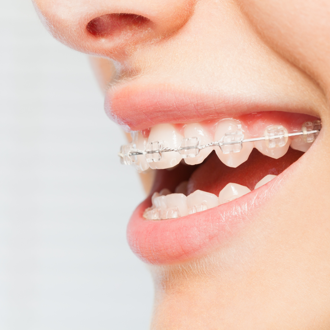 Dr. Andy Bennion Orthodontics | Orthodontist | Eugene