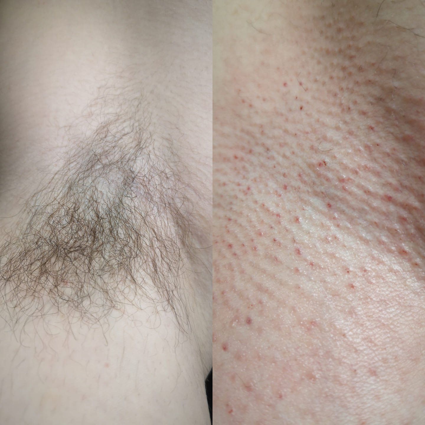 Kūno / veido depiliacijos paslaugos