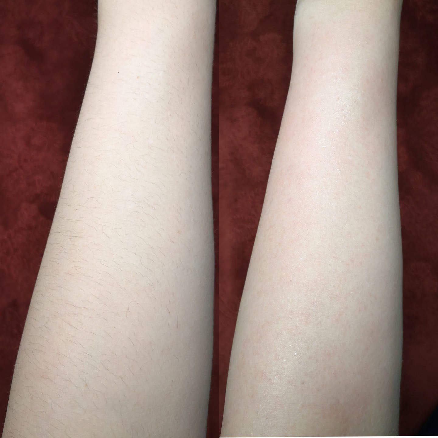 Kūno / veido depiliacijos paslaugos