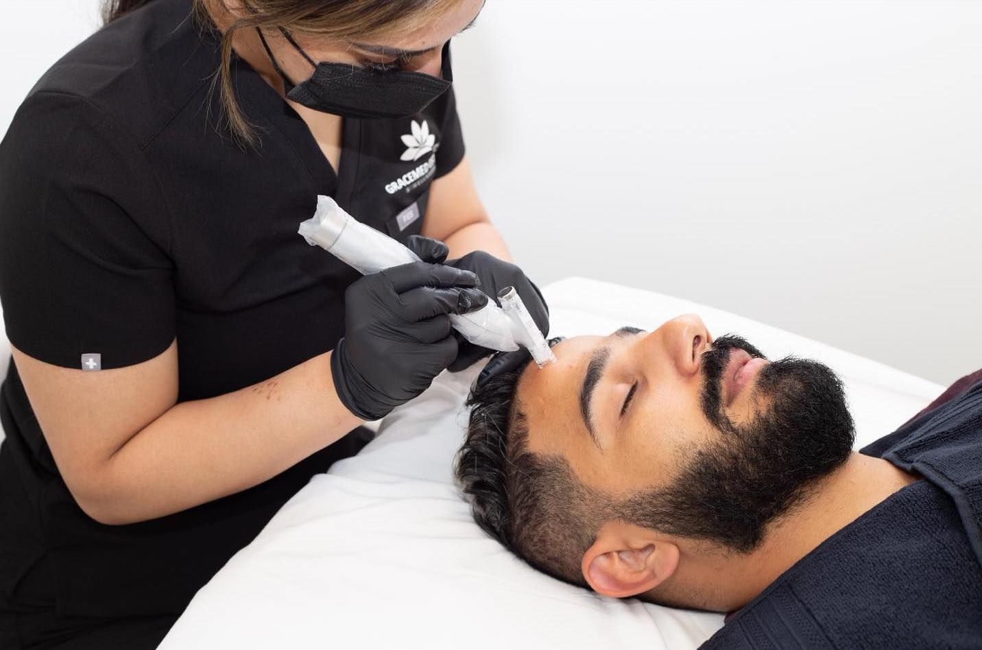 A man with a beard is getting microneedling done on his face.