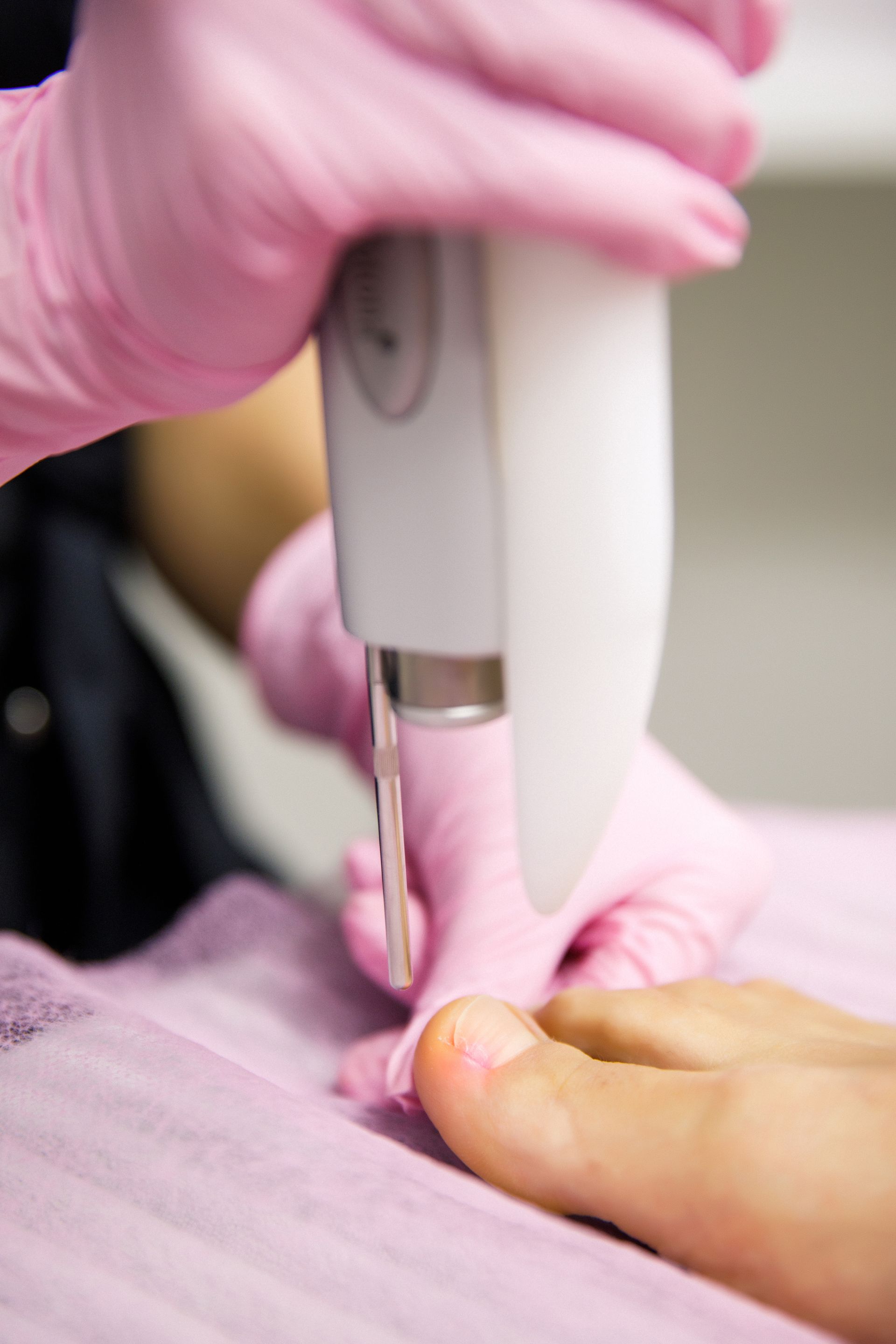 A person wearing pink gloves is getting a laser treatment on their foot.