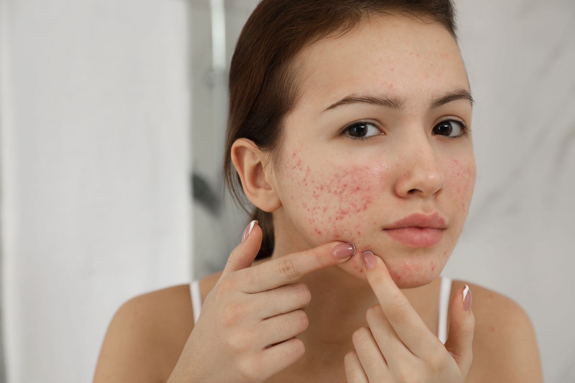 A woman with acne is looking at her face in the mirror.