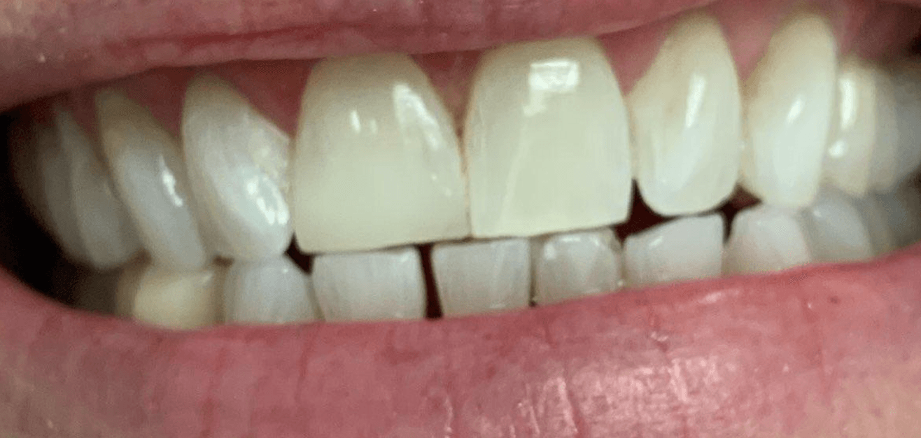 cosmetic dentistry in Louisville, Ky