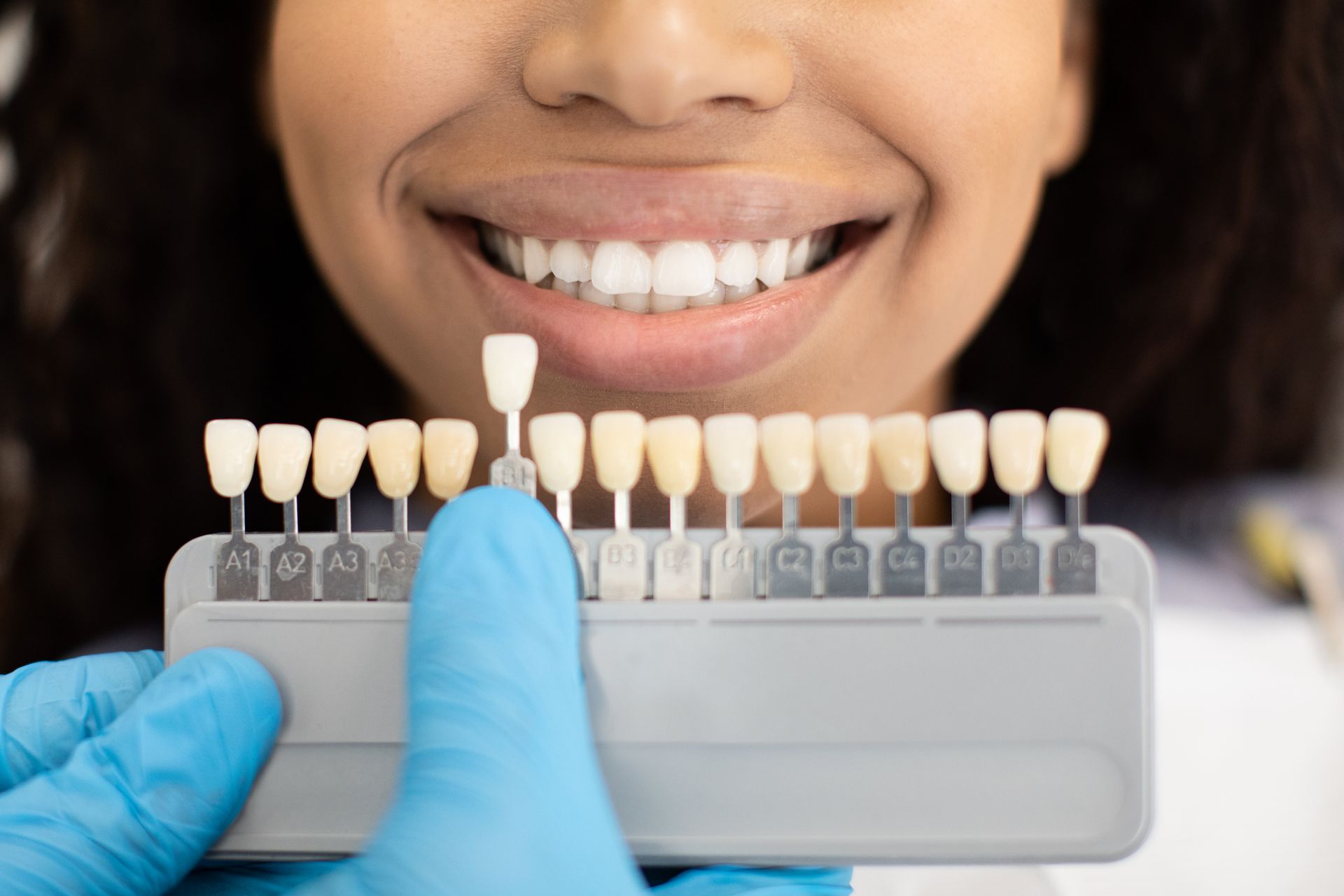 Transform Your Smile with Veneers: Your Guide to a Radiant Smile at Advanced Dental Center in Louisv