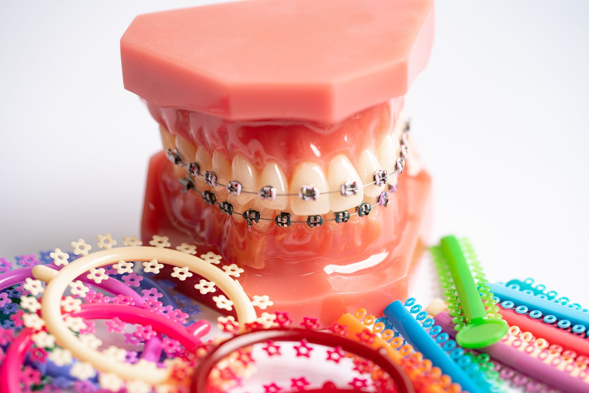 Transform Your Smile with Braces: Advanced Dental Center, Louisville, KY
