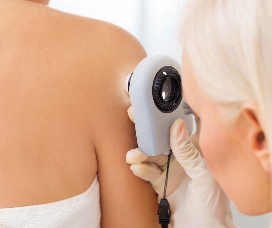 Skin Cancer Screening