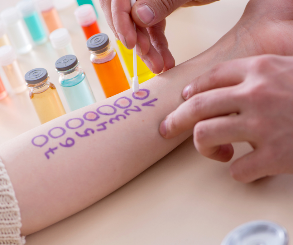 Allergy Testing