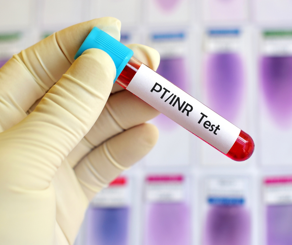 Coumadin, INR & PT Testing