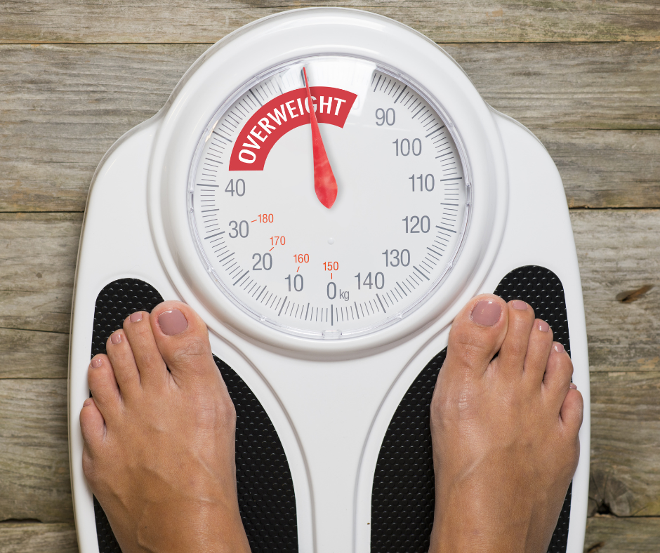 Obesity and Metabolic Syndrome Treatment