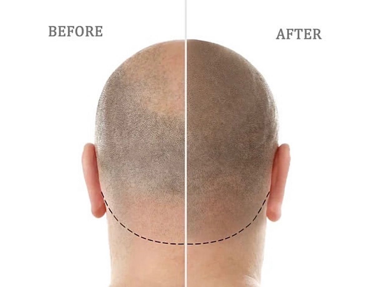 A before and after picture of a man 's head