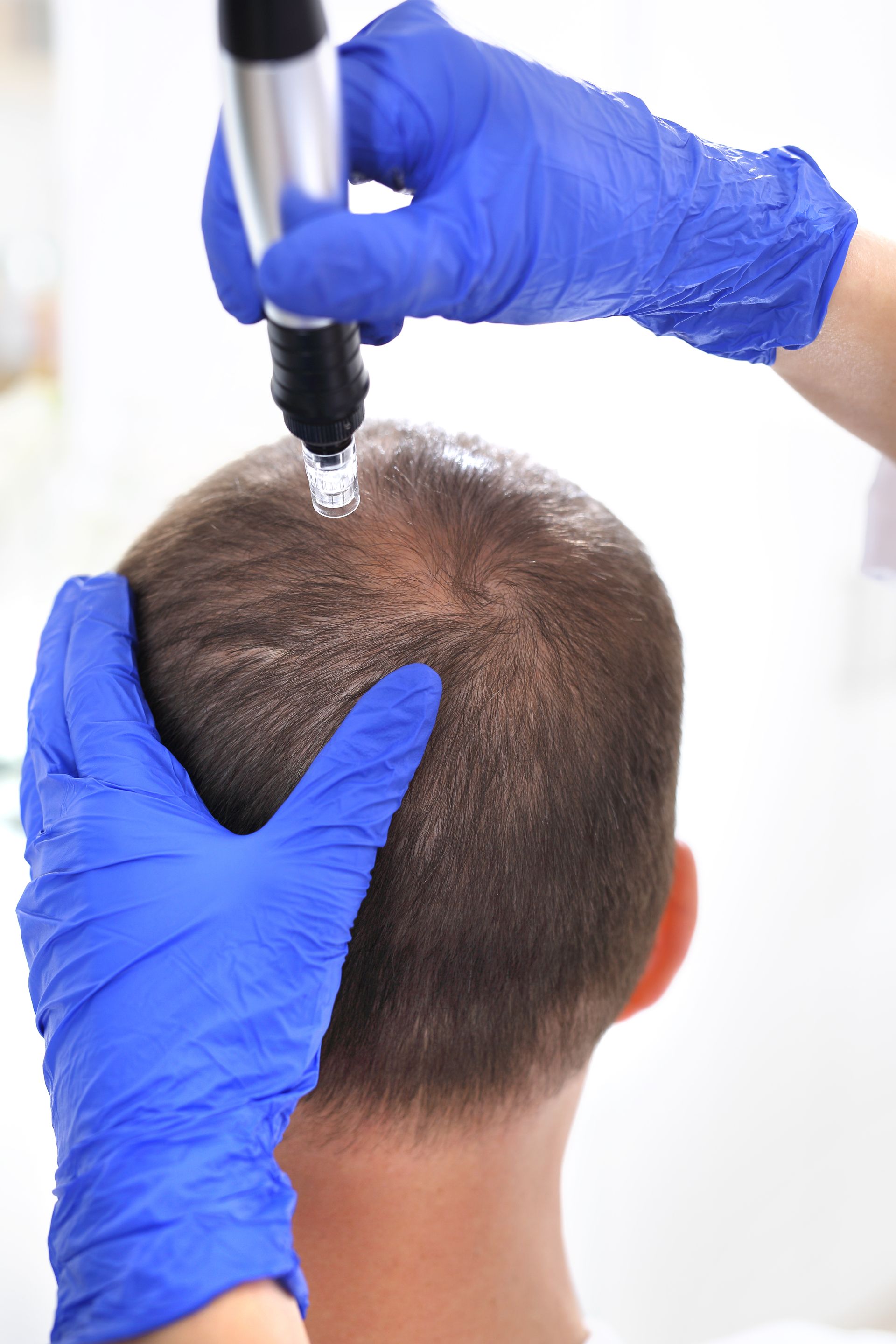 A man is getting a hair treatment from a doctor.