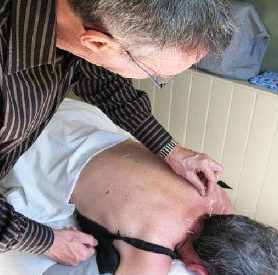 Marcel Mallette inserting acupuncture needle