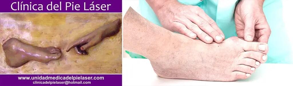 CLÍNICA DEL PIE LÁSER