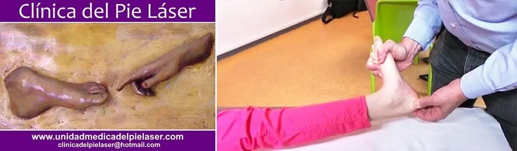 CLÍNICA DEL PIE LÁSER