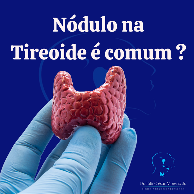 Caroço no pescoço: o que pode ser e como diagnosticar