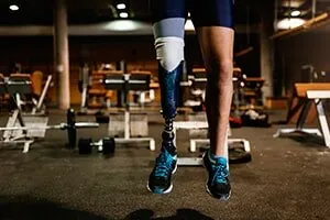 Man with Prosthetic Leg on Gym — Pembroke Pines, FL — Huse Artificial Limb & Brace