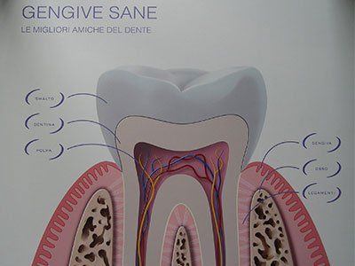 illustrazione di un dente
