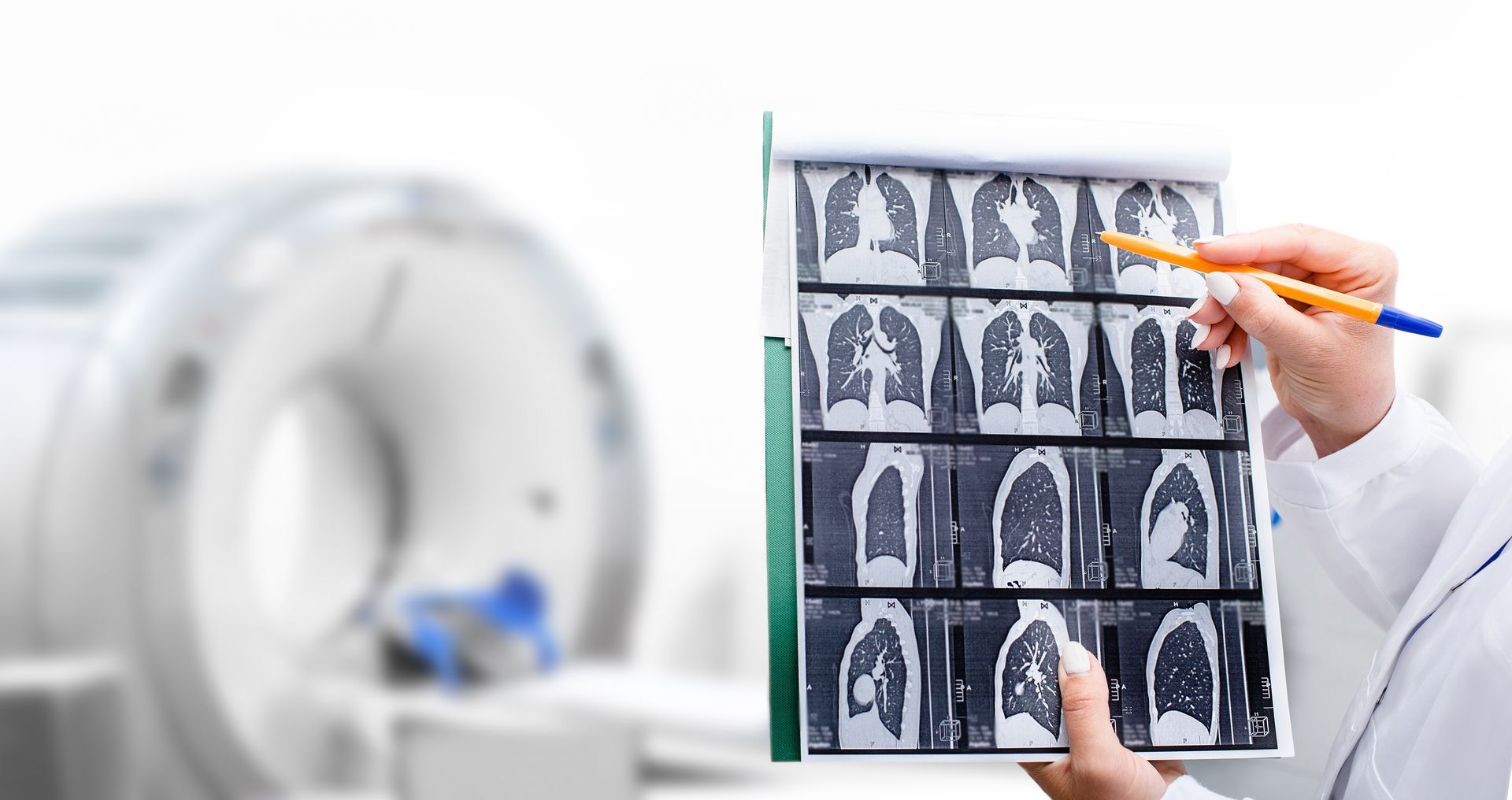 nódulo pulmonar inespecífico