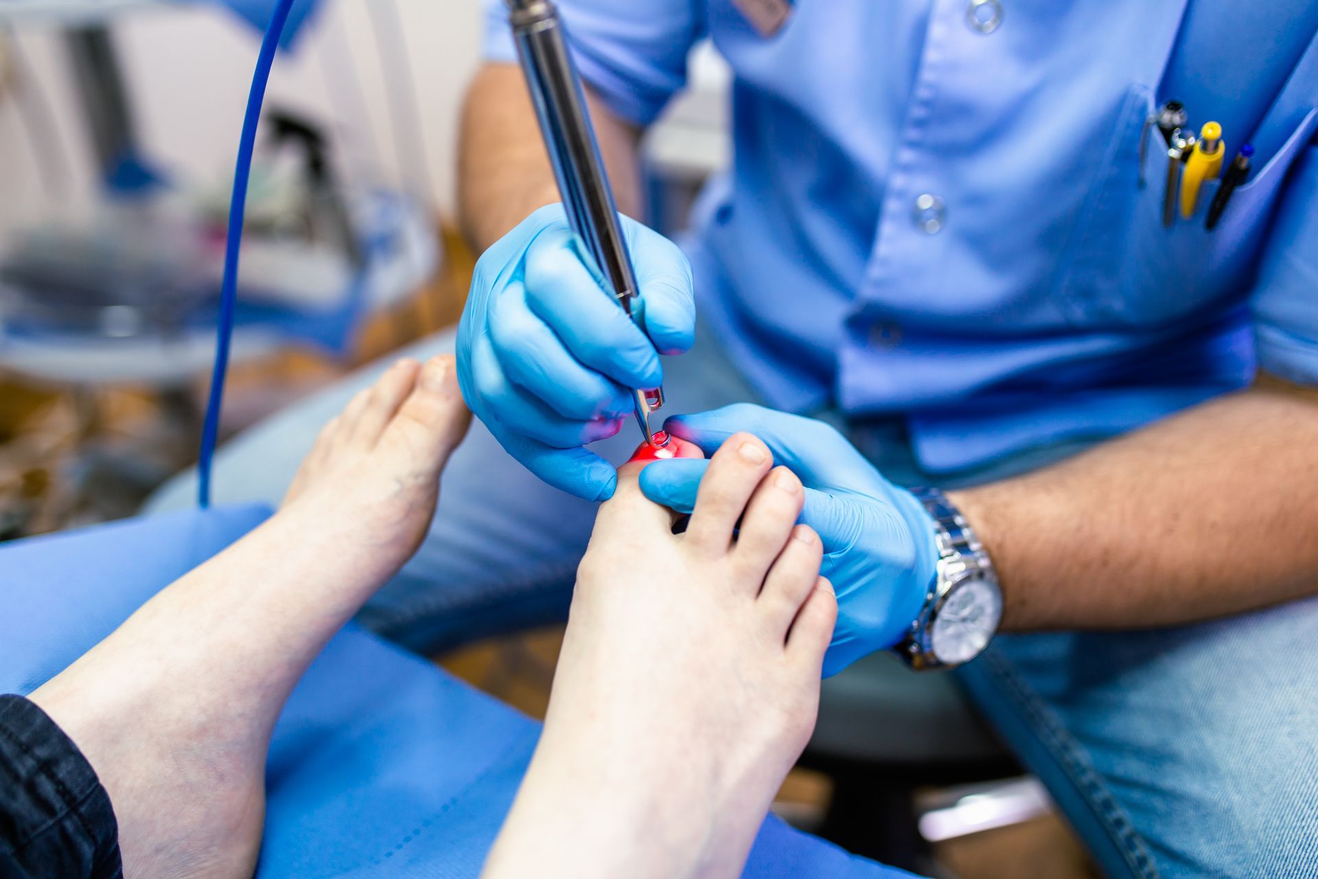 A podiatrist in blue gloves uses a tool on a patient's toe, likely performing a medical procedure.
