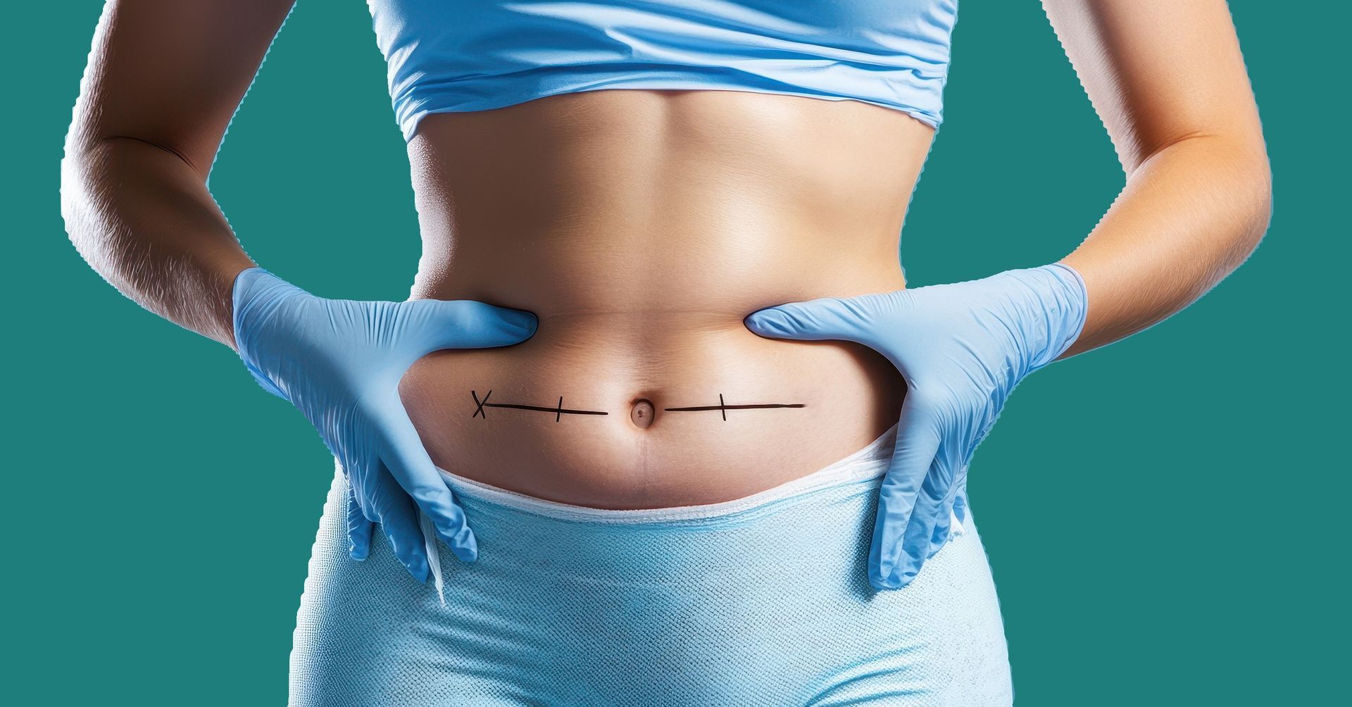 Person's abdomen with surgical markings and gloved hands, turquoise top and pants, teal background.